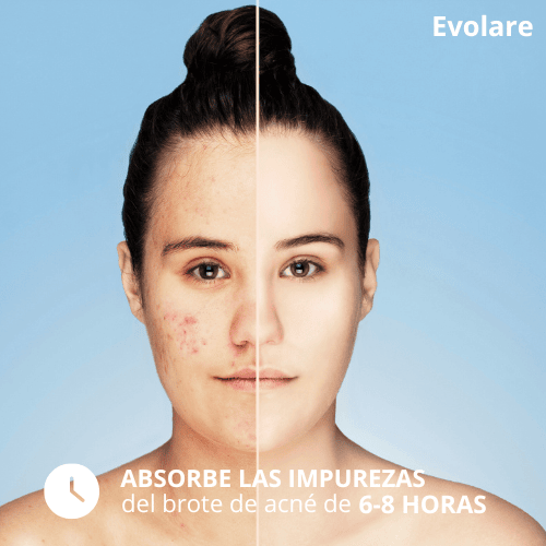 Evolare Parches Invisibles Antiacné