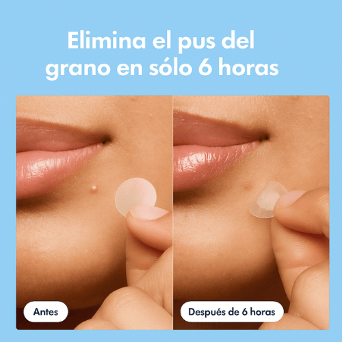 Evolare Parches Invisibles Antiacné