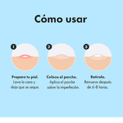 Parches Evolare